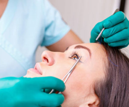 Blepharoplasty
