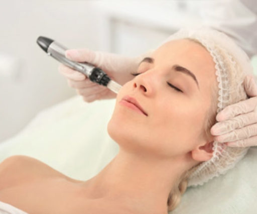 Microneedling