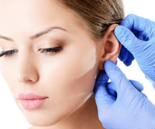 Otoplasty